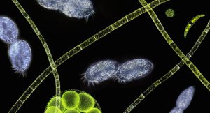 Pond water microorganisms such as Leeuwenhoek might've seen