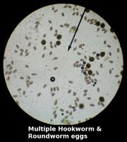 Microscopic hookworm and roundworm eggs