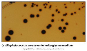 Staphylococcus aureus on tellurite-glycine medium (selective media)