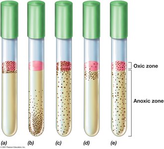 Growth patterns in thioglycolate broth