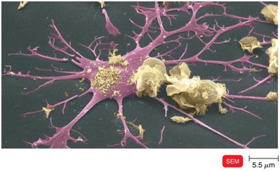 Dendritic cell