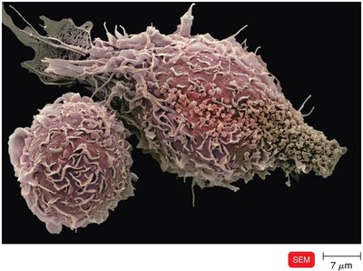 Activated macrophage