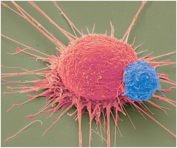 Lymphocyte attaching to cancer cell