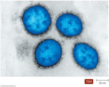 Electron micrograph of arenaviruses showing sandy appearance