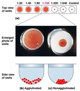 Agglutination test wells showing agglutinated and nonagglutinated samples