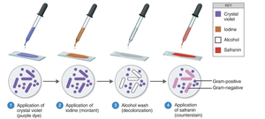 diagram of Gram stain procedure
