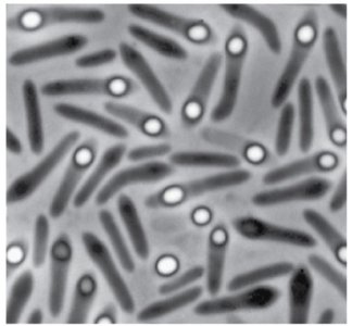 Endospore-forming bacteria under microscope