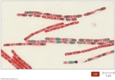 Schaeffer-Fulton stained Bacillus anthracis