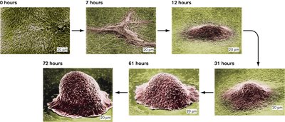 Myxobacteria life cycle: aggregation, fruiting body, spore