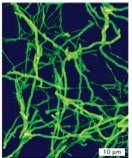 Actinomycetes aerial hyphae and spores