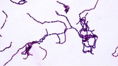 Streptococcus arrangement under microscope