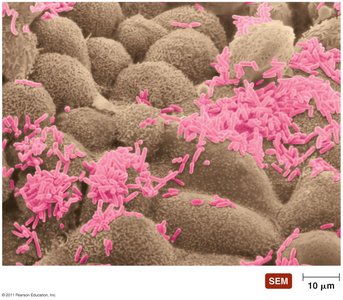 SEM of normal microbiota on host tissue
