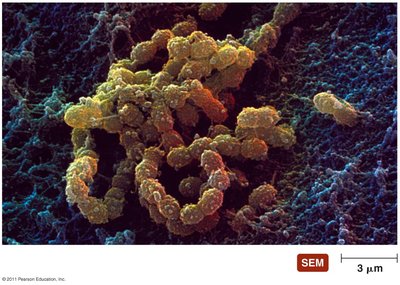 SEM of dental plaque biofilm