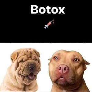 Humorous depiction of Botox effect
