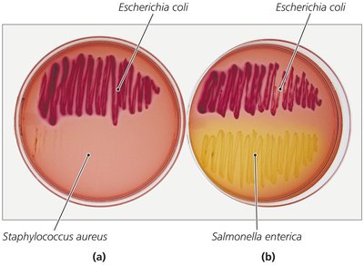 The Use of Macconkey Agar