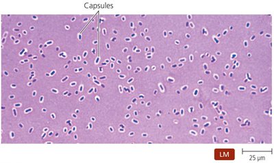 The Prominent Capsule of Klebsiella Pneumoniae