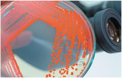 Red Colonies of Serratia Marcescens