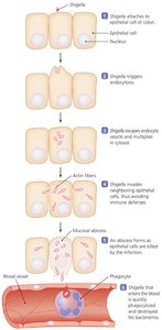 The Events in Shigellosis