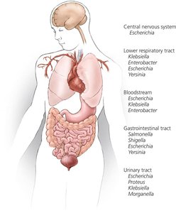 Sites of Infection by Some Common Members of the Enterobacteriaceae