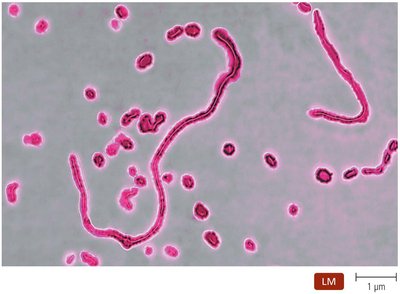 Haemophilus Influenzae Is Pleomorphic