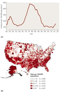 Incidence of Gonorrhea in the United States