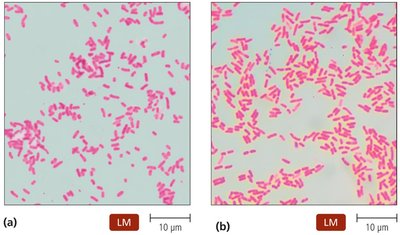 Gram Stains of Bacteria in the Family Enterobacteriaceae