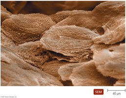 Scanning electron micrograph of the surface of human skin