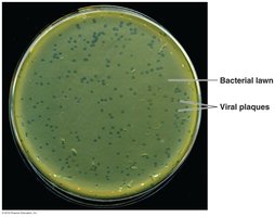Viral plaques in a lawn of bacterial growth on agar plate