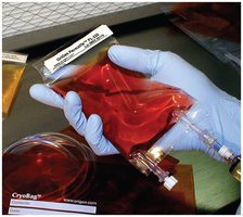 Example of cell culture