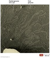 TEM image comparing the genome size of E. coli and a virus