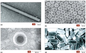 TEM images of helical, polyhedral, and complex viruses