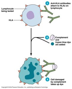 Diagram of HLA typing using antibodies and complement