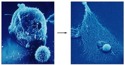 Electron micrograph of immune cell attacking a cancer cell