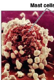 Electron micrograph of a mast cell