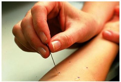Skin testing for allergies