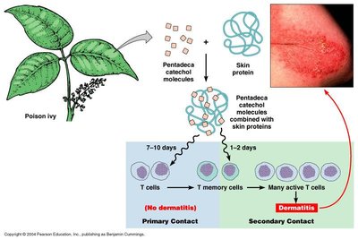 Poison ivy contact dermatitis and T cell response