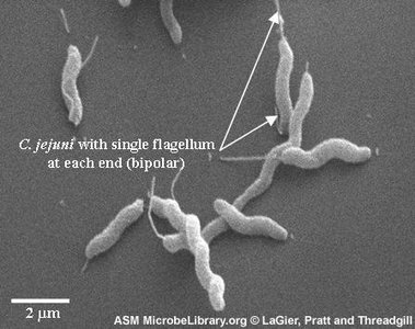 Electron micrograph of Campylobacter jejuni with bipolar flagella