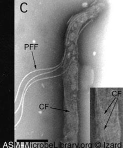 Electron micrograph showing periplasmic flagella