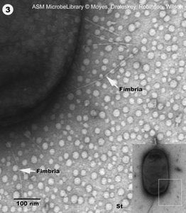 Electron micrograph of fimbriae on bacterial surface