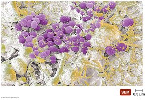 SEM of biofilm formation (dental plaque)