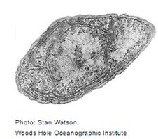 Electron micrograph of ammonia-oxidizing bacterium