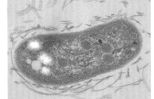 Nitrobacter electron micrograph