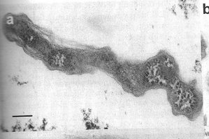 Nitrospira electron micrograph