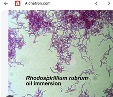 Rhodospirillum rubrum under oil immersion