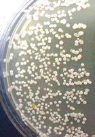 Bacterial colonies on nutrient agar plate, Time 4