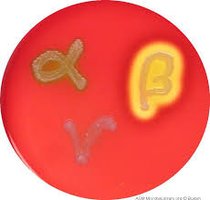 Blood agar plate showing alpha, beta, and gamma hemolysis