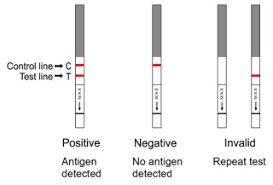 Group A Streptococcus antigen test results