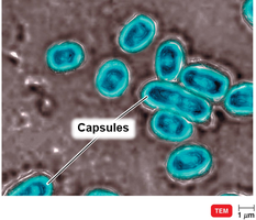 Bacterial capsules under TEM