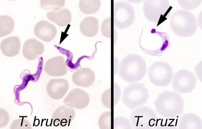 Trypanosoma brucei and Trypanosoma cruzi in blood smear