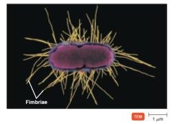 Fimbriae on bacterial cell